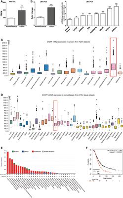 The Exocrine Differentiation and Proliferation Factor (EXDPF) Gene Promotes Ovarian Cancer Tumorigenesis by Up-Regulating DNA Replication Pathway